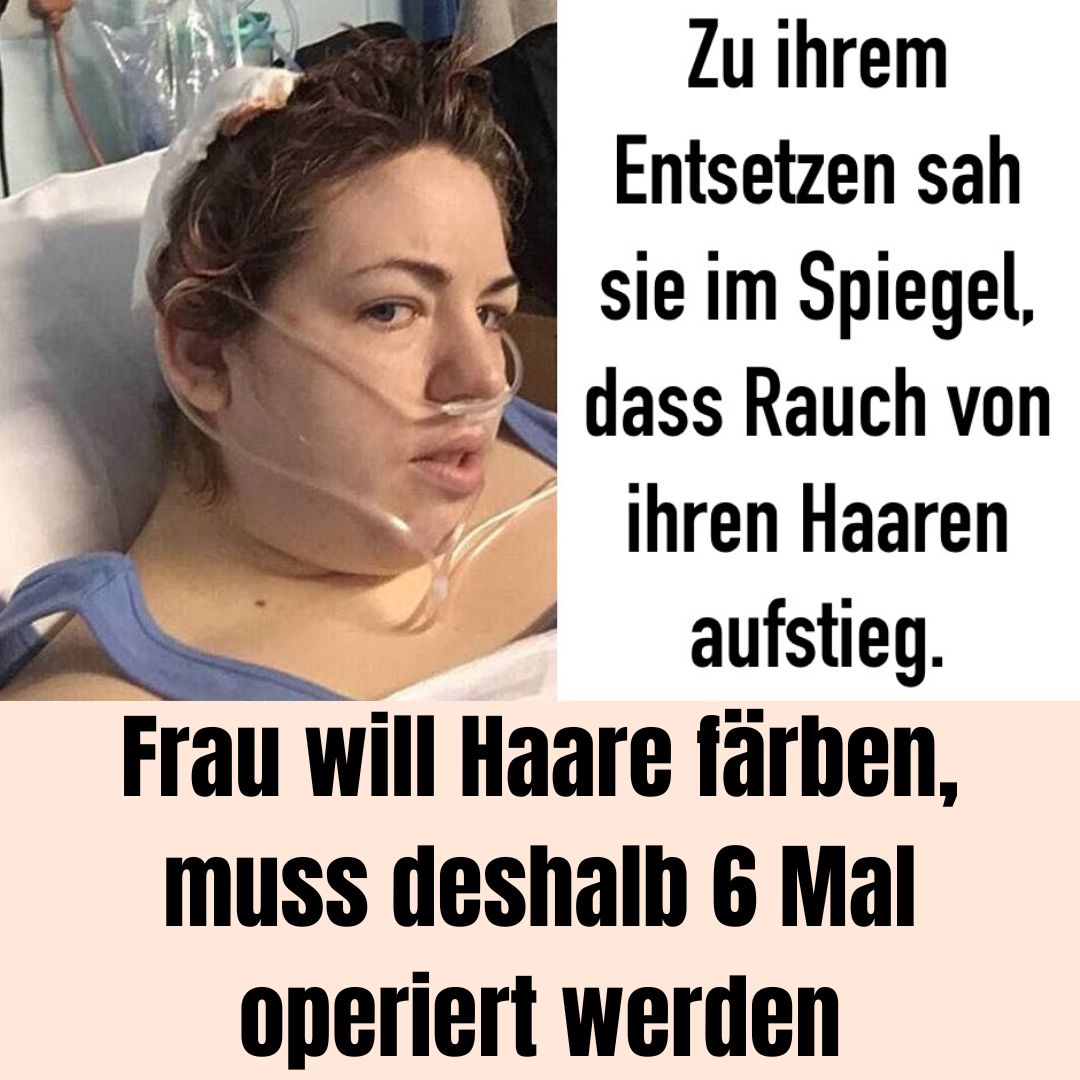 Frau will Haare färben, muss deshalb 6 Mal operiert werden