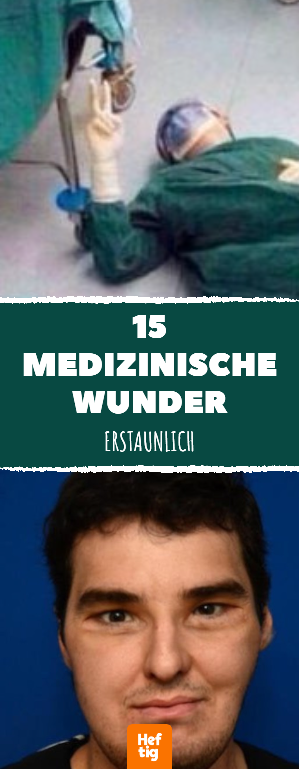 15 medizinische Wunder, die unvergesslich sind