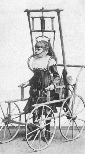 Ein Schwarzweiß-Bild von einem orthopädischen Apparat, ca. 1900.