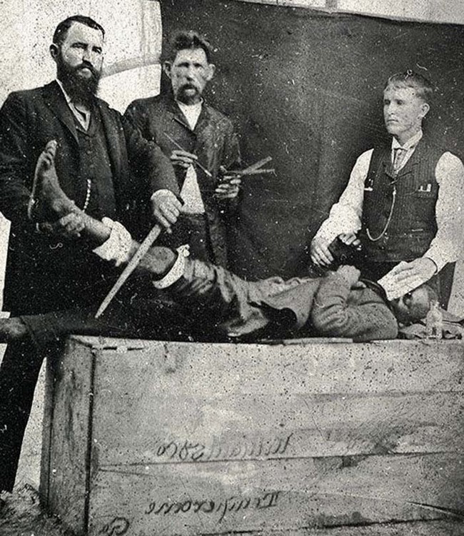 Ein Schwarzweiß-Foto einer Bein-Operation, 1855-1860.