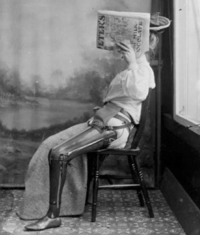 Eine Frau trägt eine Beinprothese. Schwarzweißfoto, ca. 1890.