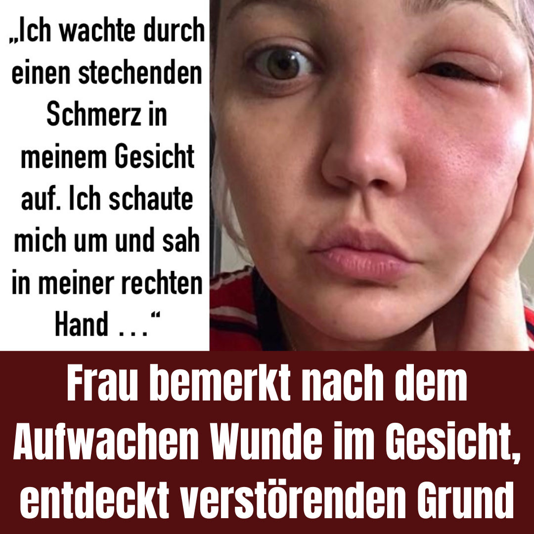 Aufgewachte Frau spürt Wunde im Gesicht, in Hand liegt Übeltäter