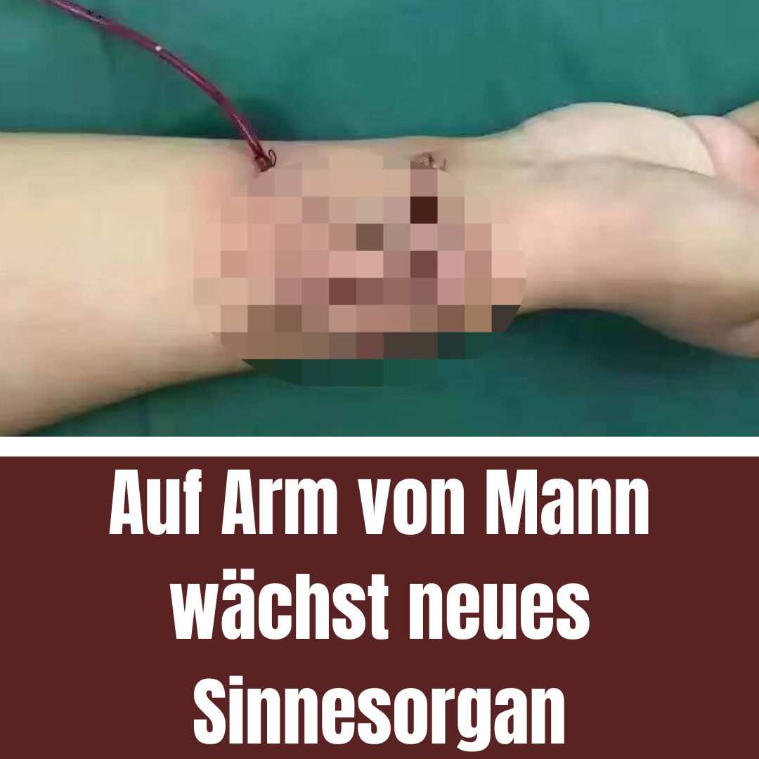 Arzt gibt Mann auf ungewöhnliche Weise Ohr zurück